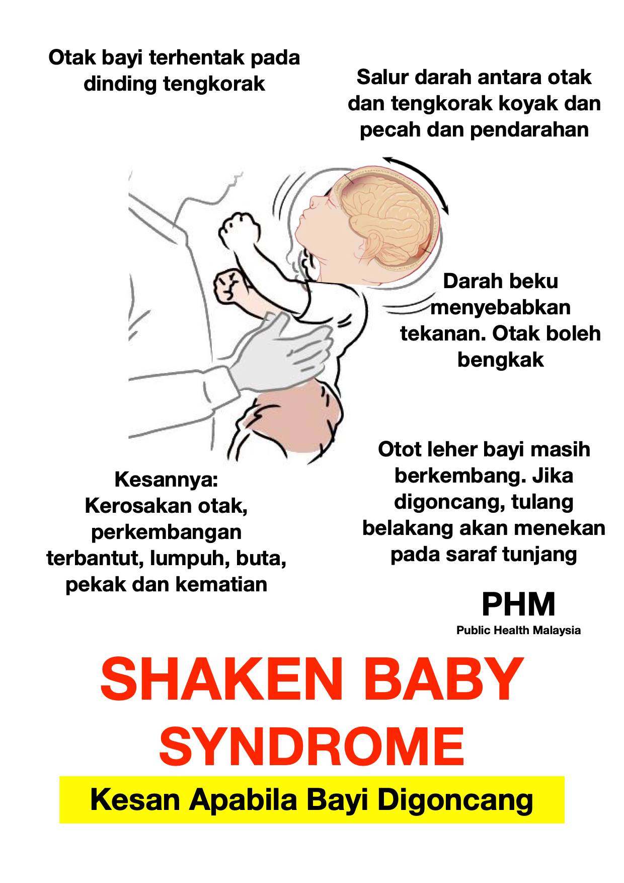 bahaya goncang bayi